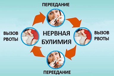 Лечение булимии в Ипатово